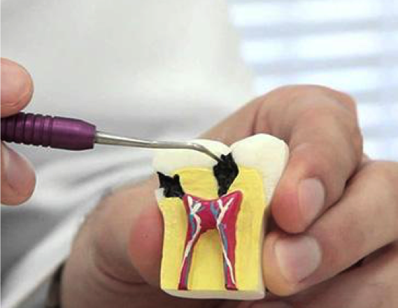 endodontia
