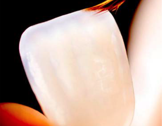 lentes-de-contato-facetas