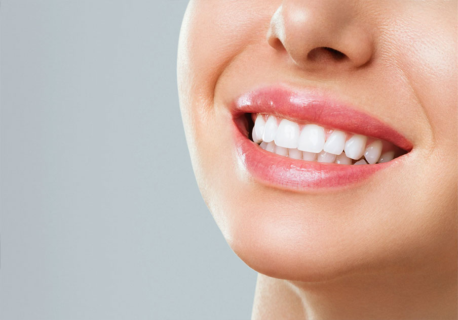 Clareamento Dental na Vila Clementino