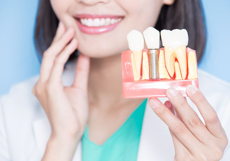 Implante Dentário na Vila Clementino