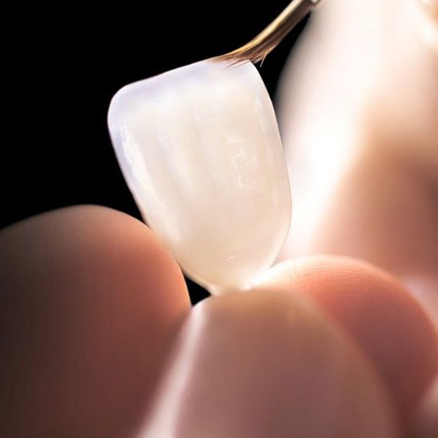Lente de Contato Dental - Vila Clementino Lente de Contato Dental - Vila Clementino