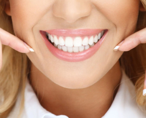 Lentes de Contato Dental - Vila Clementino