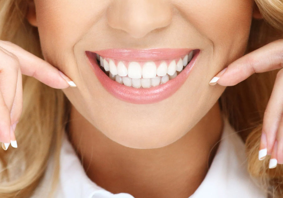 Lentes de Contato Dental - Vila Clementino